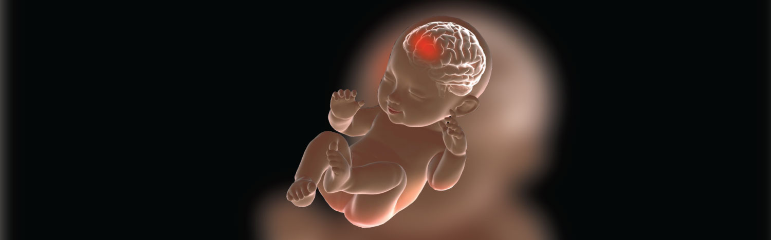 Jury Awards $30.6 Million For Brain Injury Caused At Birth