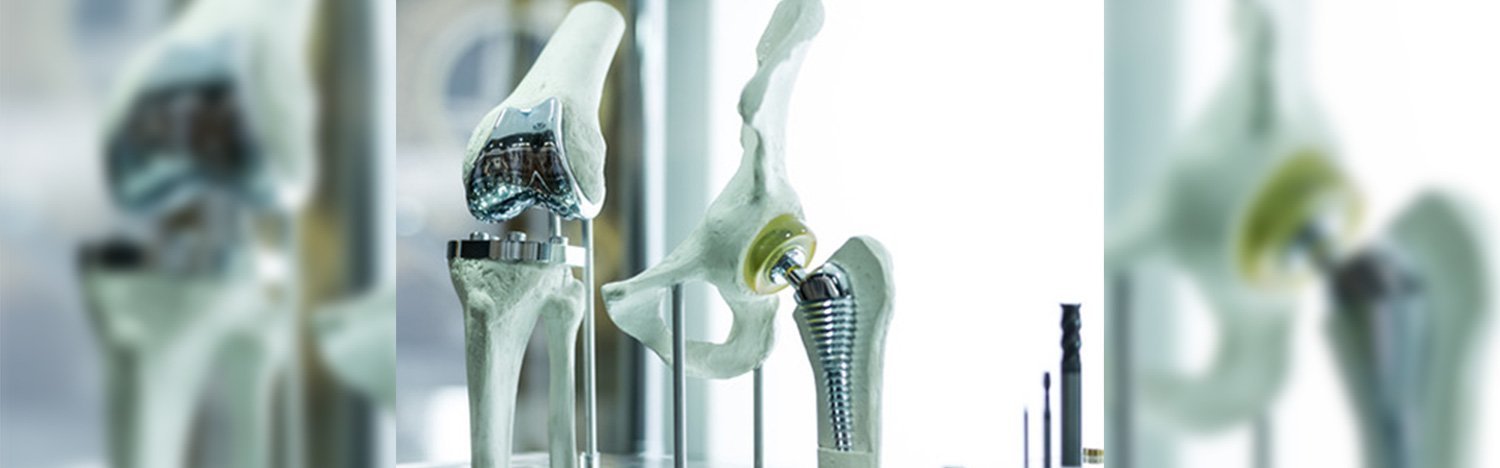 Zimmer Kinectiv Hip Replacement Case Filed Over Metallosis