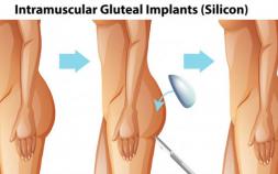 JPML To Consider Profemur Hip Implant MDL Consolidation