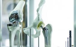 Zimmer Kinectiv Hip Replacement Case Filed Over Metallosis