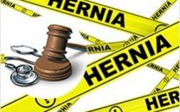 Ethicon Faces Defective Design Lawsuit For Its Hernia Mesh 