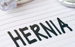  JMPL Agrees To Centralize 70 Hernia Mesh Lawsuits