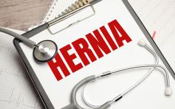 Judge To Meet Hernia Mesh MDL's Lawyers For 2023 Trial